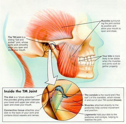 tmj enlarged